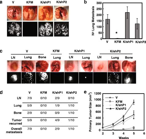 Pgc 1α Knockdown Reverses Kiss1 Mediated Metastasis Suppression In