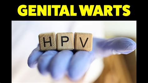 Genital Warts Diagnosis Treatment Home Tips Dermatologist Explains Youtube