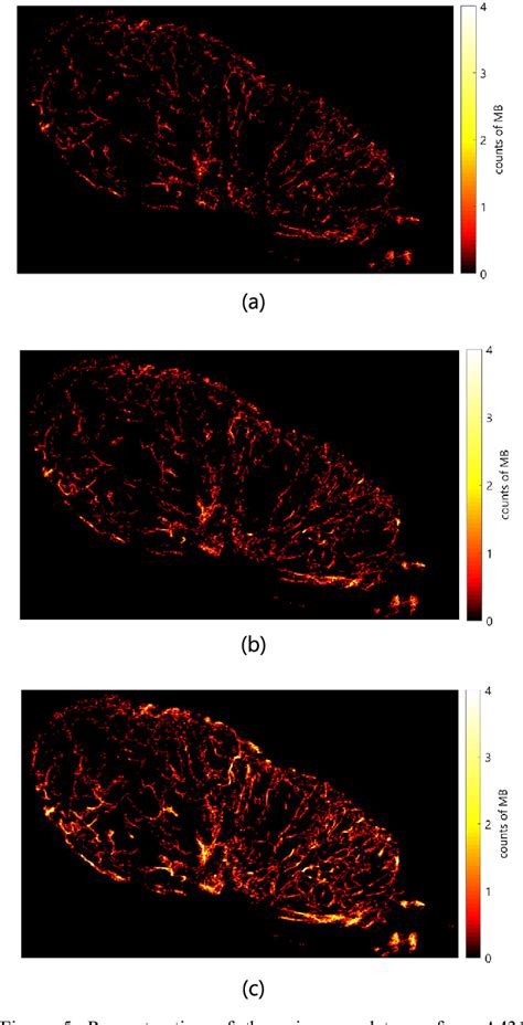 Ultrasound Localization Microscopy Semantic Scholar