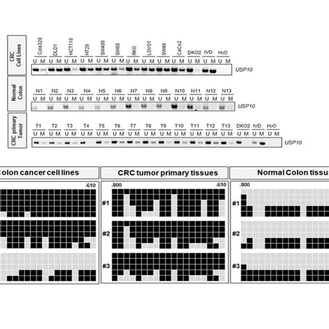 Methylation Analysis Of The Usp Promoter Regions In Colorectal Cancer