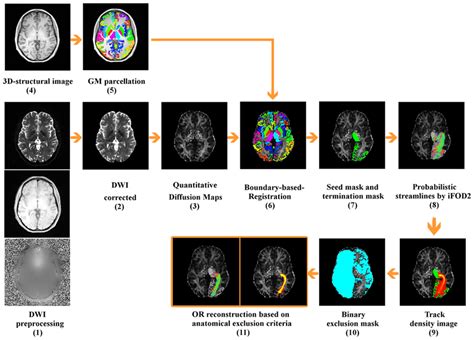 Tractography Reconstruction Framework Of The Optic Radiations 1 Download Scientific Diagram