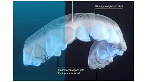 Align Technology Introduces New Invisalign Moderate Package World