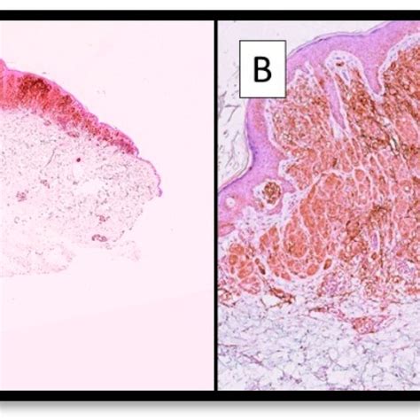 A Photomicrograph Showing An Example Of Immunostaining For Tim In A