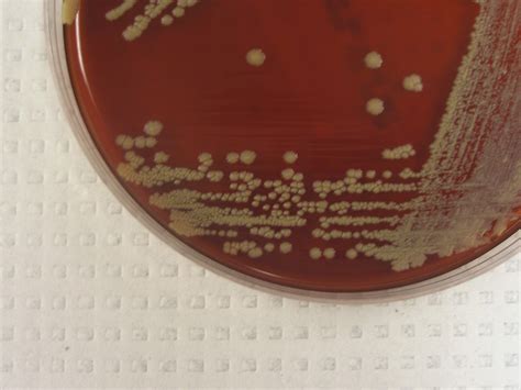 Corynebacterium Virtual Lab Microbiology