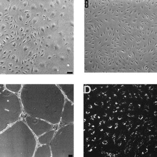 Cultured Human Myometrial Microvascular Endothelial Cells Phase