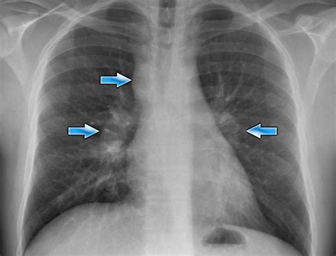 The Radiology Assistant Basic Interpretation