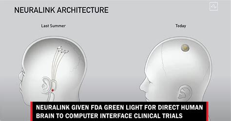 Neuralink Given Fda Green Light For Direct Human Brain To Computer