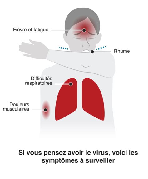 Coronavirus Quels Sont Les Derniers Sympt Mes Bbc News Afrique