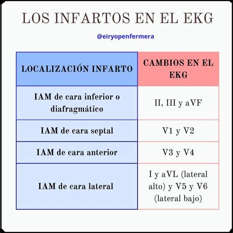 Los Infartos Y Derivaciones En El Ekg Sergio Udocz