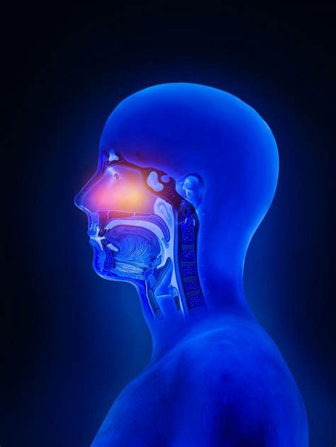 Symptoms of Sinusitis