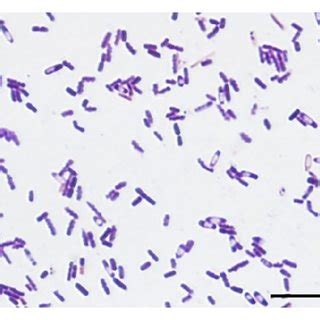 Clostridium Tertium Gram Stain