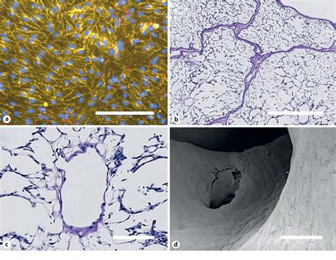 Figure 1 From Recent Advances In Decellularization And