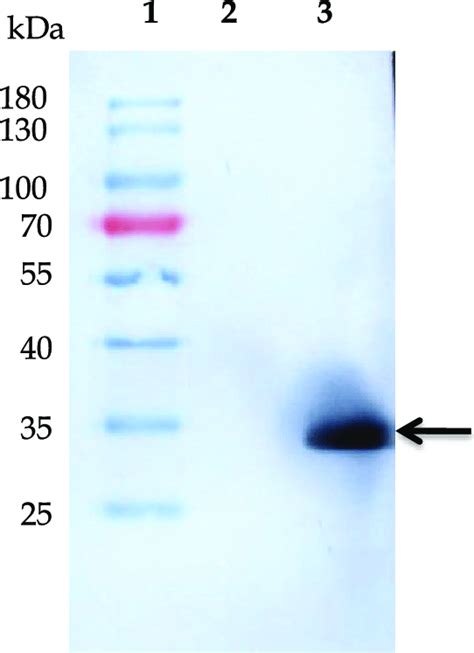 Western Blot Analysis Of Recombinant Mrt Western Blot Profile Showing