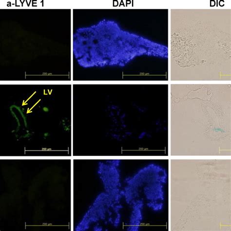 Immunofluorescence Staining Of The Primo Tissues With Lyve 1 The