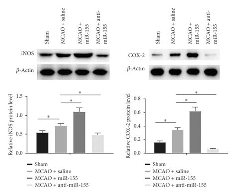 Knockdown Of Mir 155 Relieved Ischemia Injury In Mice With Mcao A