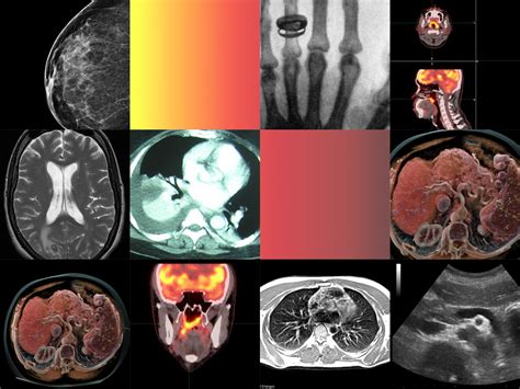 Timeline: a history of medical imaging - pharmaphorum