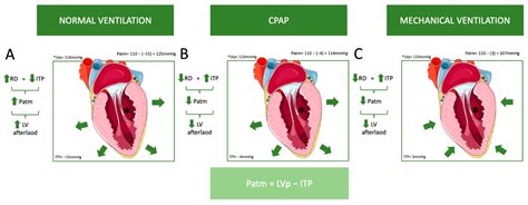 Navigating Heart–Lung Interactions in Mechanical Ventilation