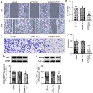 Knockdown Of Circ Pvt Inhibits The Invasion And Migration Of A