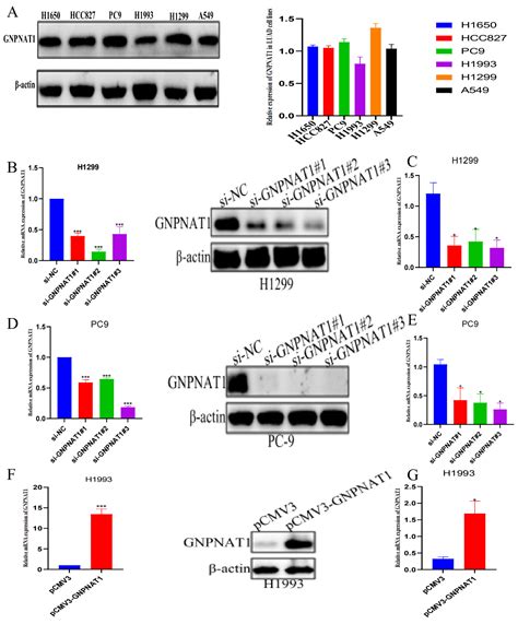 Gnpnat Serves As A Prognostic Biomarker Correlated With Immune