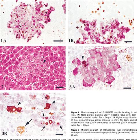 Label The Photomicrograph Photomicrographs Illustrating The Different