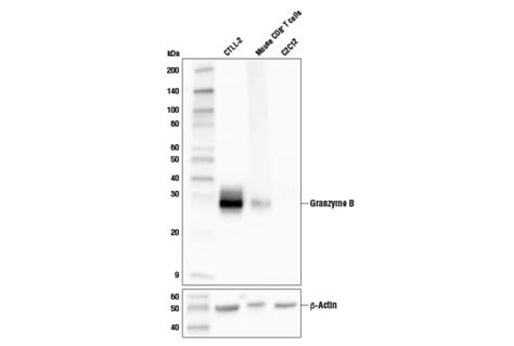 Granzyme B D6e9w Rabbit Mab Cell Signaling Technology