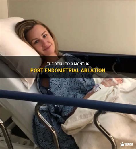 The Results 3 Months Post Endometrial Ablation MedShun