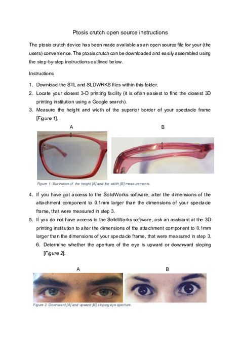 Pdf Open Source Modular Ptosis Crutch For Myasthenia Gravis