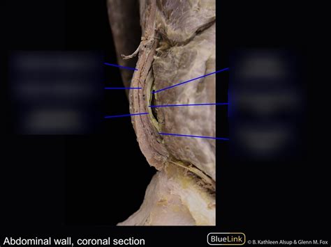 Abdominal Wall Coronal Section Diagram Quizlet