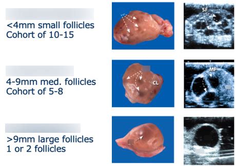 Diagram of Ultrasound appearance of follicles | Quizlet