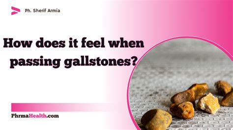 Passing A Gallstone How Does It Feel Phrmahealth