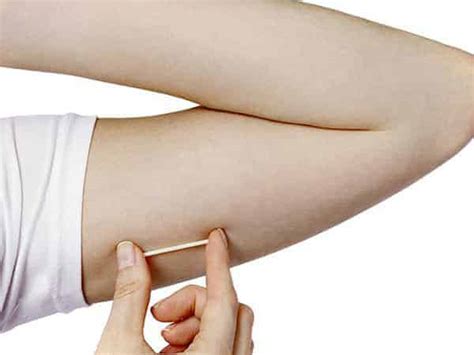 Contraceptive Implant fitting or removal | M3 Health Melbourne