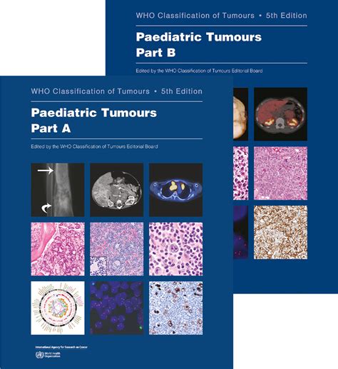 Who Classification Of Tumours Th Ed Vol In Vols Paediatric