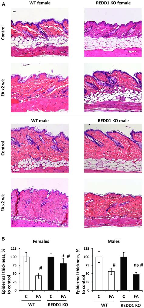 Redd1 Ko Female But Not Male Mice Are Protected Against Glucocorticoid Download Scientific