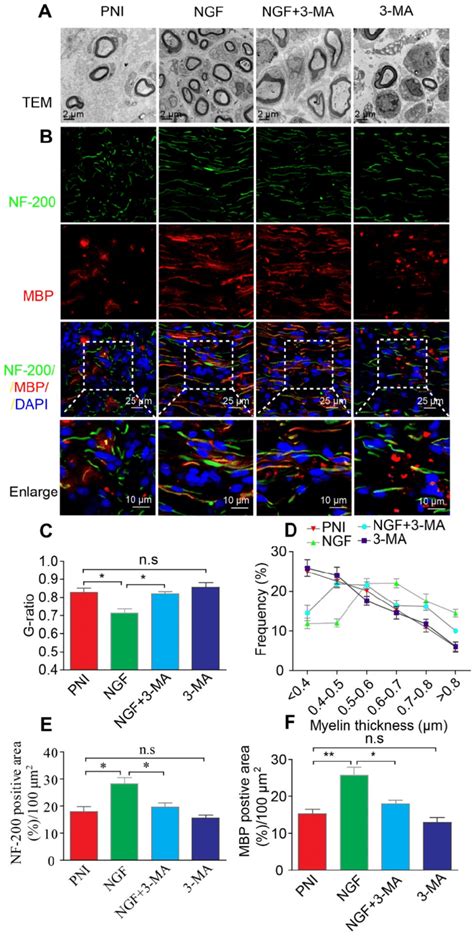 Autophagy Inhibition Suppresses Nerve Regeneration A B Electron