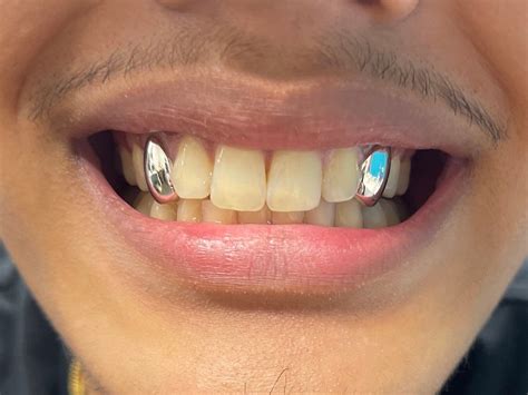 X Sterling Silver Grillz Any Teeth Uk Worldwide Shipping Etsy