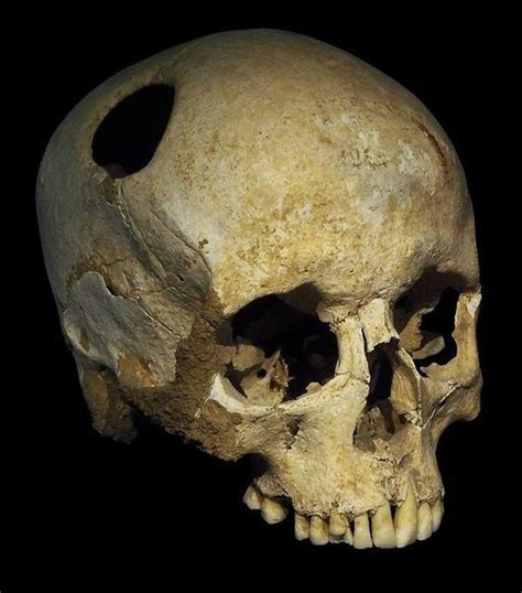 Pin By Derald Hallem On Skull Art Weird History Facts Stone Age Man