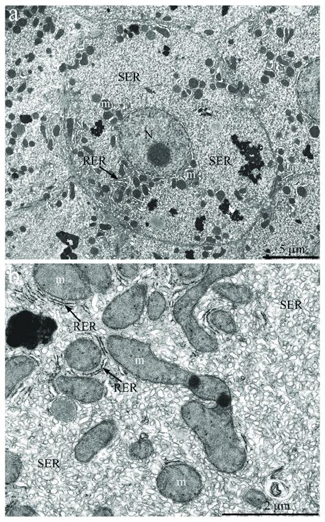 Hepatocyte Ultrastructure Of H Glaber Aged 11 Years A Overview Download Scientific Diagram