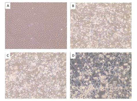 Collection Of Sars Cov Virus From The Air Of A Clinic Within A