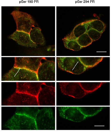 Ppr Colocalizes At The Cell Membrane With E Cadherin Download Scientific Diagram