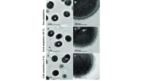 TEM image of Leuconostoc mesenteroides WiKim32. Control (non-adapted)... | Download Scientific ...