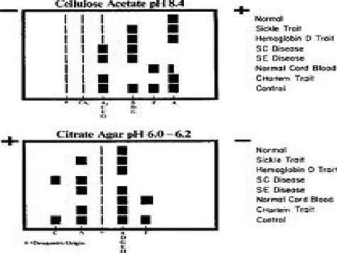 Practical Hematology Lab LAB 13 Hemoglobin Electrophoresis Electrophoresis