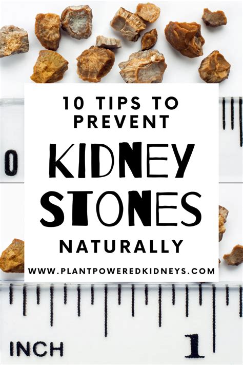 10 Tips To Prevent Kidney Stones Naturally