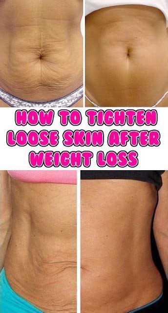 Fitness And Beauty How To Tighten Loose Skin After Weight Loss