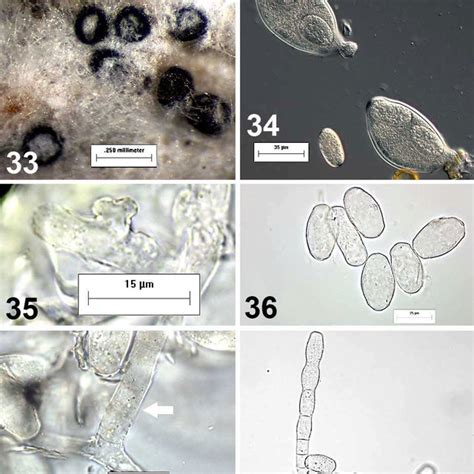 Diagnostic Features Of Phyllactinia Illustrated With P Guttata 39