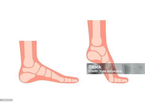 siluet kaki manusia  tulang kaki ortopedi kaki sehat kaki penuh