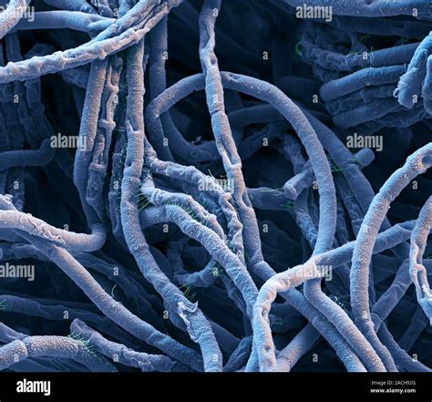 Anthrax Bacteria Coloured Scanning Electron Micrograph Sem Of