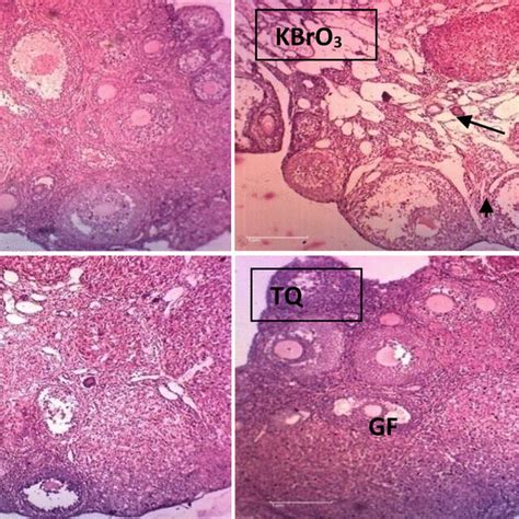 Histopathological Changes In The Uterine Section Of Female Mice Mus