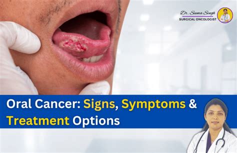 Understanding Oral Cancer: Signs, Symptoms, and Treatment Options - Dr ...