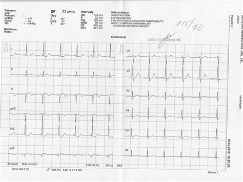 Ekg Z Praxe Medic Na Nemoci Studium Na Lf Uk