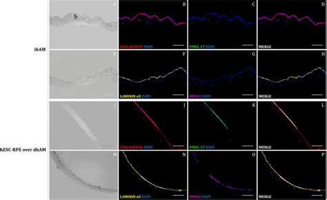 Immunofluorescent Staining Of Rpe Differentiation Markers Pmel 17 C